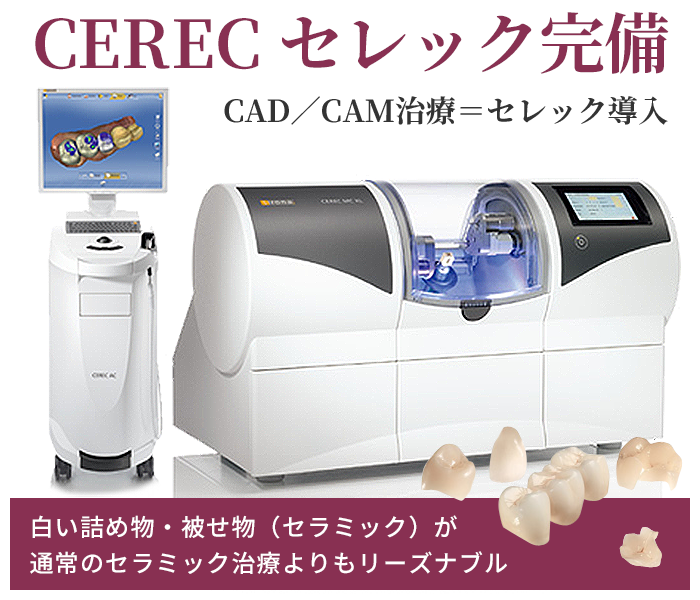 SIRONA CEREC(セレック)