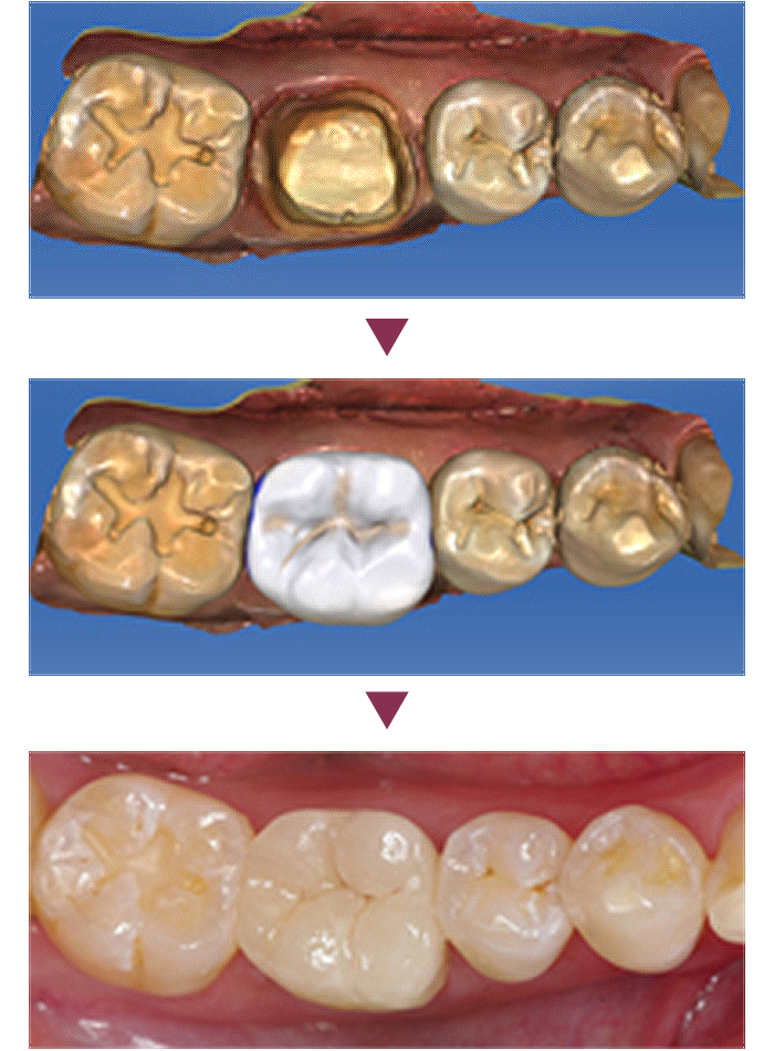 SIRONA CERECiZbNj