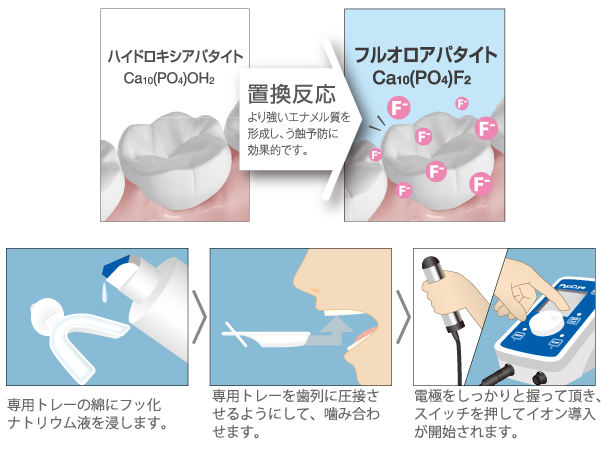 パイオキュアー説明図