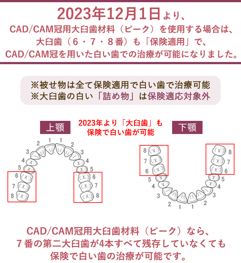 CAD/CAMの保険適用範囲