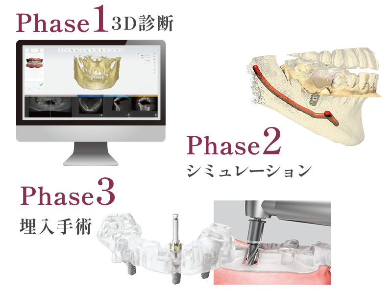 オステムワンガイド