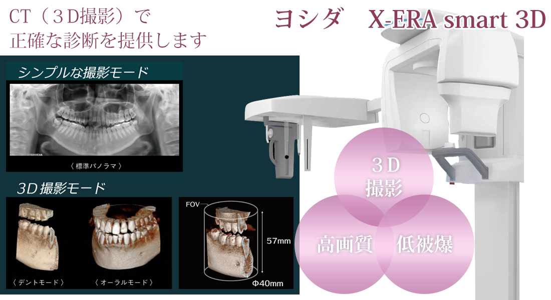 CTレントゲン