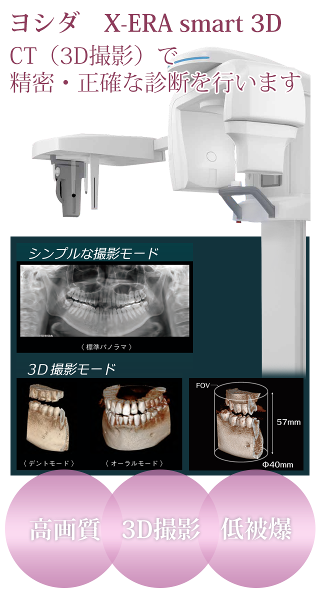 CTレントゲン