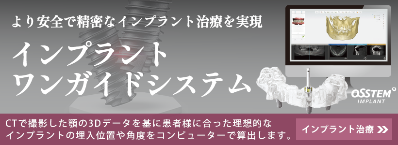 オステムワンガイド