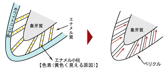 ホワイトニング